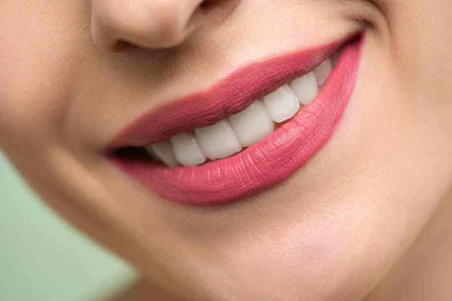 Teeth Whitening Teeth Whitening